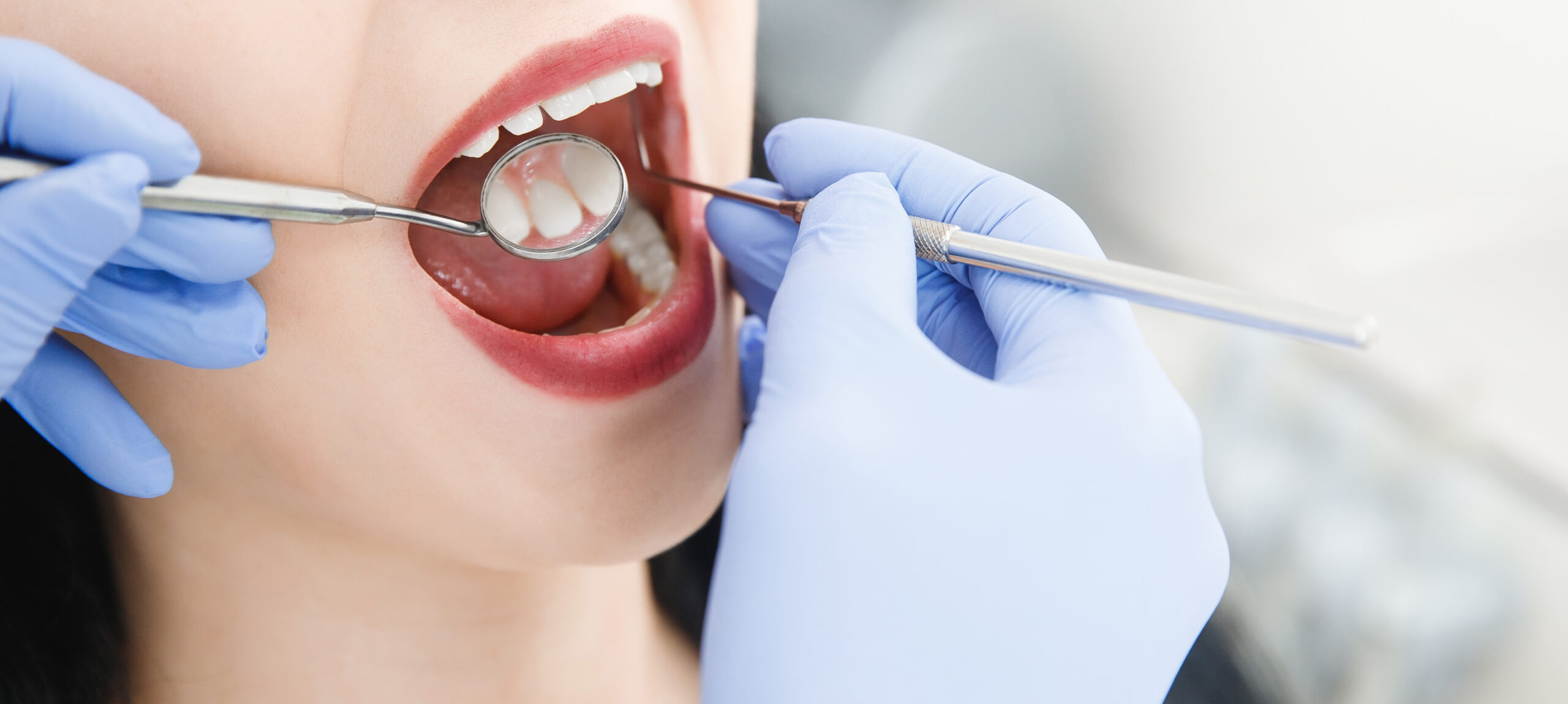 Smiling pretty woman is having her teeth examined by dentist in clinic. Concept of caries treatment
